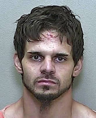 Silver Springs man arrested after bruised woman claims he imprisoned her