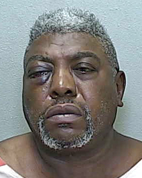 Ocala man with a black eye jailed after nasty spat