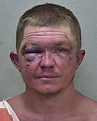 Accused batterer gets black eye from witness