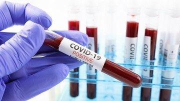 5 more local COVID-19 fatalities as Florida reports 96 more virus-related deaths