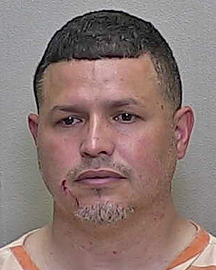 Dunnellon man accused of stretching woman’s lips in assault