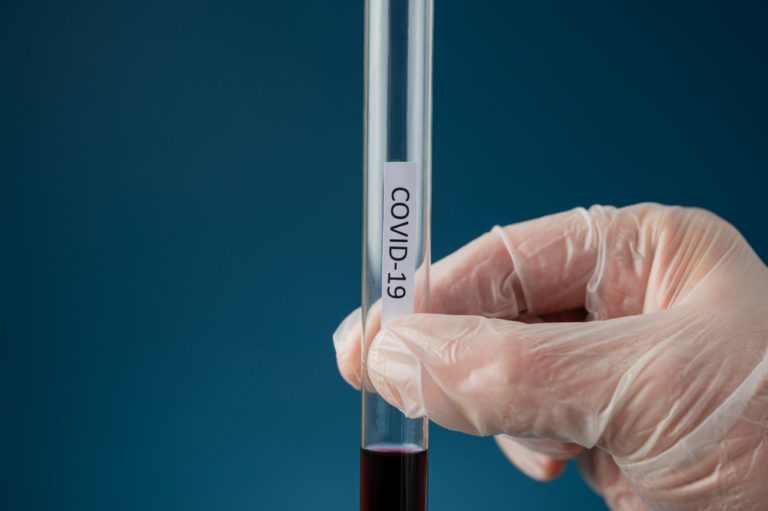 COVID 19 test tube