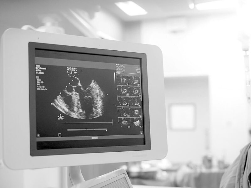 Cardiogram